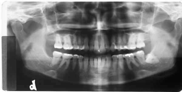 Radiografia original sem retoques