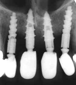 laudo4.jpg (84430 bytes)